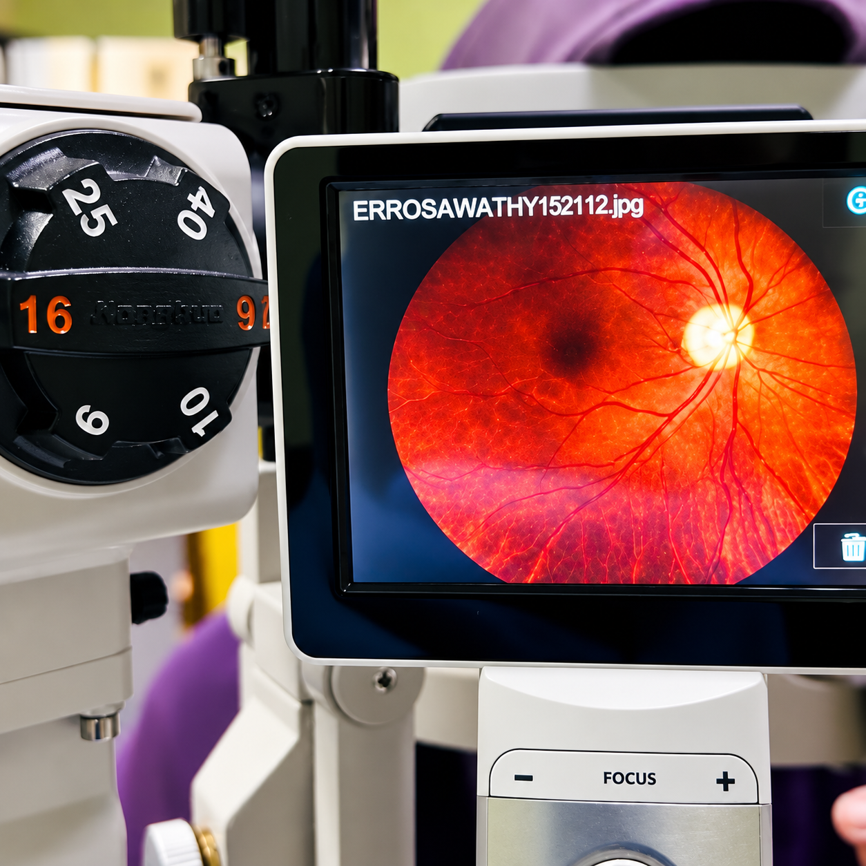 Pemeriksaan Retina Mata